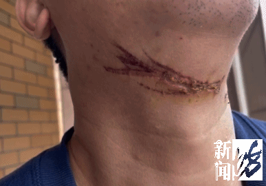 触目惊心！外卖小哥骑车被割喉 现场老人迅速离开